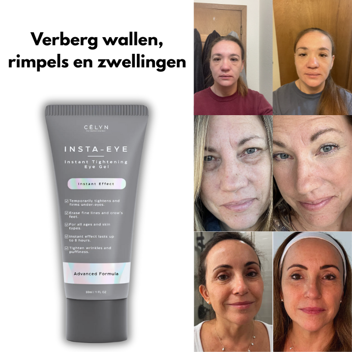 Celyn Oogcrème | 1+1 Gratis