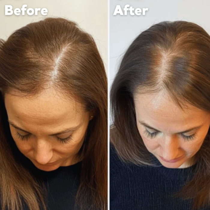 DermaHair